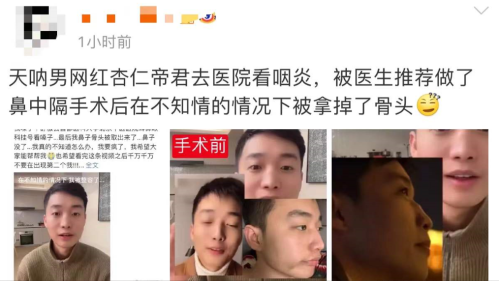 男网红咽喉不适去医院结果鼻子被整容(杏仁帝君网上维权是什么原因)