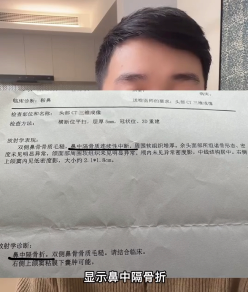 男网红咽喉不适去医院结果鼻子被整容(杏仁帝君网上维权是什么原因)