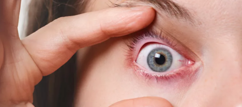 什么是葡萄膜炎有哪些症状？(出现这样的“红眼”一定要当心！严重或可致盲)